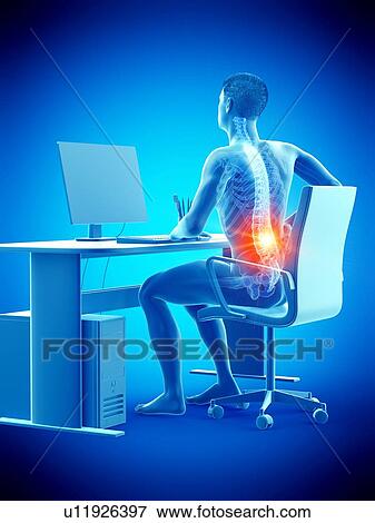 Office worker with back pain, conceptual illustration. View Large Photo Image Stock Photo - Office worker with back pain, conceptual illustration.. Fotosearch
