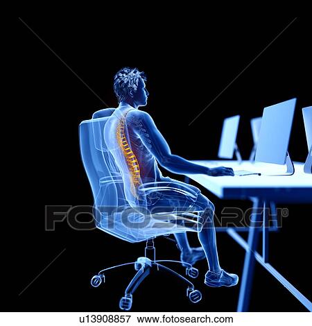 Stock Photo - Office worker with back pain, illustration. Fotosearch
