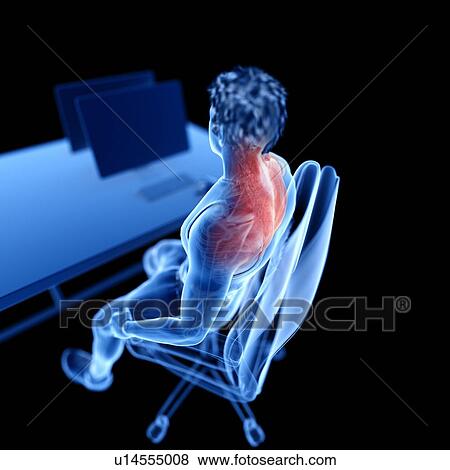 Stock Photo - Office worker with back pain, illustration. Fotosearch