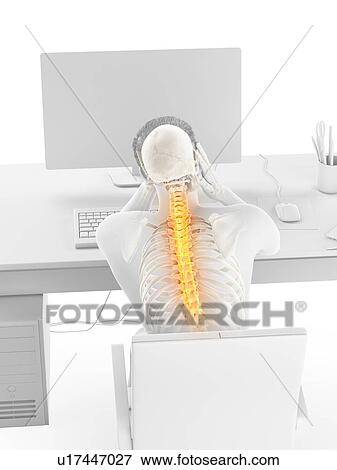 Stock Photo - Office worker with back pain, conceptual illustration.. Fotosearch