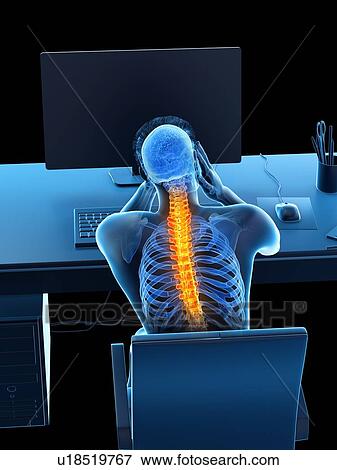 Stock Photo - Office worker with back pain, conceptual illustration.. Fotosearch