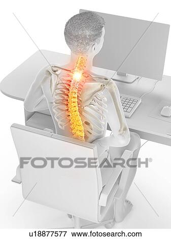 Office worker with back pain, conceptual illustration. View Large Photo Image Stock Photo - Office worker with back pain, conceptual illustration.. Fotosearch