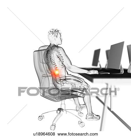 Office worker with back pain, illustration View Large Photo Image Stock Photo - Office worker with back pain, illustration. Fotosearch