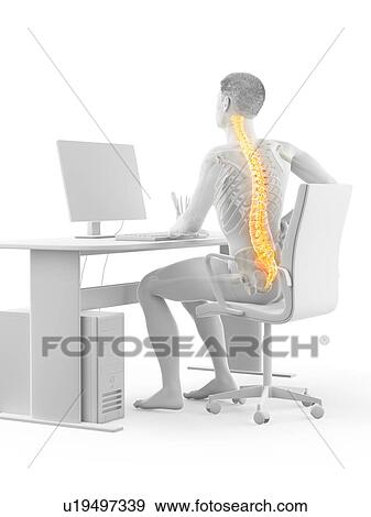 Stock Photo - Office worker with back pain, conceptual illustration.. Fotosearch