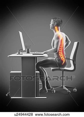 Stock Photo - Office worker with back pain, conceptual illustration.. Fotosearch