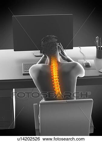 Stock Photograph - Office worker with back pain, conceptual illustration.. Fotosearch