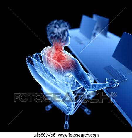 Office worker with back pain, illustration View Large Photo Image Stock Photograph - Office worker with back pain, illustration. Fotosearch