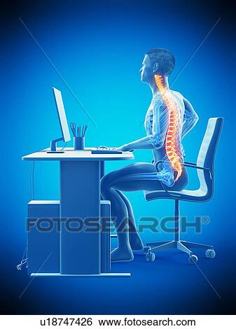 Stock Photograph - Office worker with back pain, conceptual illustration.. Fotosearch