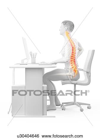 Stock Photograph - Office worker with back pain, conceptual illustration.. Fotosearch