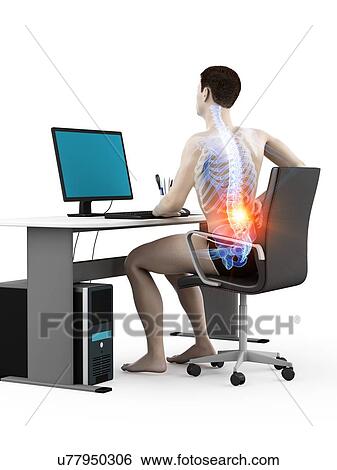 Stock Photograph - Office worker with back pain, conceptual illustration.. Fotosearch