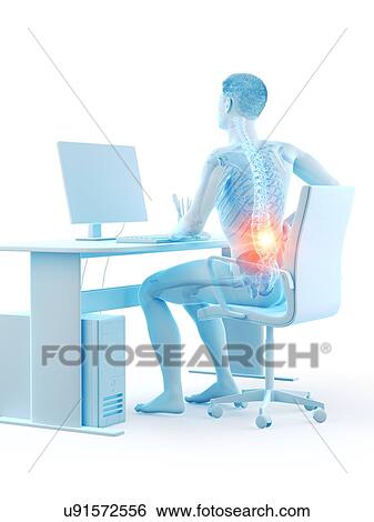 Stock Photograph - Office worker with back pain, conceptual illustration.. Fotosearch