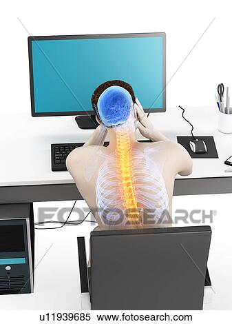 Office worker with back pain, conceptual illustration. View Large Photo Image Stock Photography - Office worker with back pain, conceptual illustration.. Fotosearch