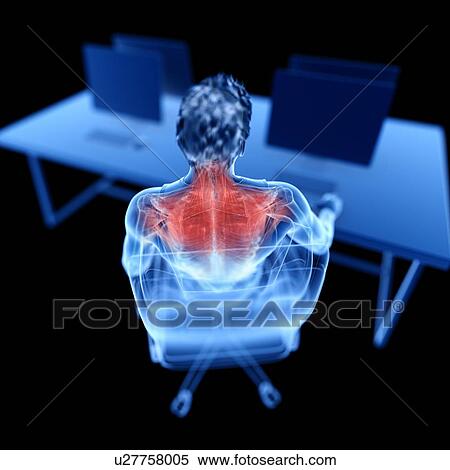 Stock Photography - Office worker with back pain, illustration. Fotosearch