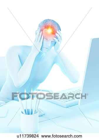 Picture - Office worker with headache, conceptual illustration.. Fotosearch