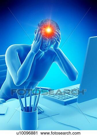 Stock Image - Office worker with headache, conceptual illustration.. Fotosearch