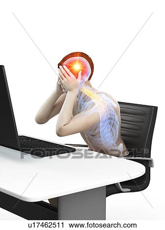 Stock Image - Office worker with headache, conceptual illustration.. Fotosearch