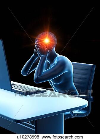 Office worker with headache, conceptual illustration. View Large Photo Image Stock Photo - Office worker with headache, conceptual illustration.. Fotosearch