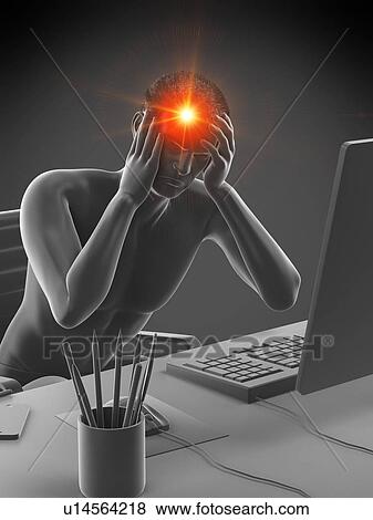 Office worker with headache, conceptual illustration. View Large Photo Image Stock Photo - Office worker with headache, conceptual illustration.. Fotosearch