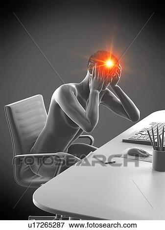 Office worker with headache, conceptual illustration. View Large Photo Image Stock Photo - Office worker with headache, conceptual illustration.. Fotosearch