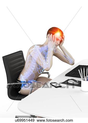 Office worker with headache, conceptual illustration. View Large Photo Image Stock Photo - Office worker with headache, conceptual illustration.. Fotosearch