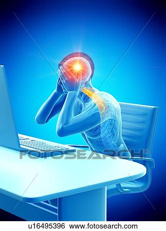 Stock Photograph - Office worker with headache, conceptual illustration.. Fotosearch