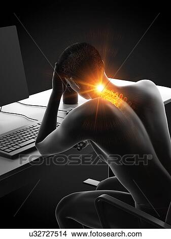 Picture - Office worker with neck pain, conceptual illustration.. Fotosearch