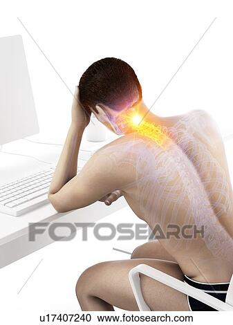 Stock Image - Office worker with neck pain, conceptual illustration.. Fotosearch