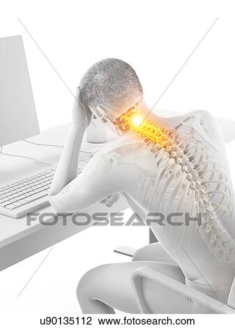 Stock Image - Office worker with neck pain, conceptual illustration.. Fotosearch