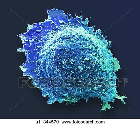Osteoblast bone cell. Coloured scanning electron micrograph (SEM) of an osteoblast bone cell. Osteocytes are osteoblasts (bone-producing cells) that have become trapped within bone cavities (lacunae, depressions in bone). They produce and secrete the... View Large Photo Image Stock Image - Osteoblast bone cell. Coloured scanning electron micrograph (SEM) of an osteoblast bone cell. Osteocytes are osteoblasts (bone-producing cells) that have become trapped within bone cavities (lacunae, depressions in bone). They produce and secrete the.... Fotosearch