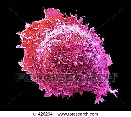 Stock Image - Osteoblast bone cell. Coloured scanning electron micrograph (SEM) of an osteoblast bone cell. Osteocytes are osteoblasts (bone-producing cells) that have become trapped within bone cavities (lacunae, depressions in bone). They produce and secrete the.... Fotosearch