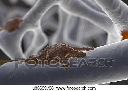 Stock Photo - Osteoclast, illustration. Fotosearch