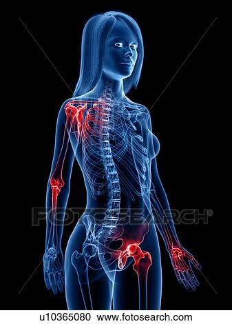 Painful joints, conceptual illustration View Large Photo Image Stock Image - Painful joints, conceptual illustration. Fotosearch