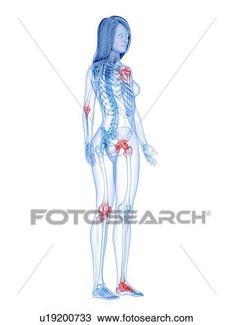 Painful joints, conceptual illustration View Large Photo Image Stock Image - Painful joints, conceptual illustration. Fotosearch