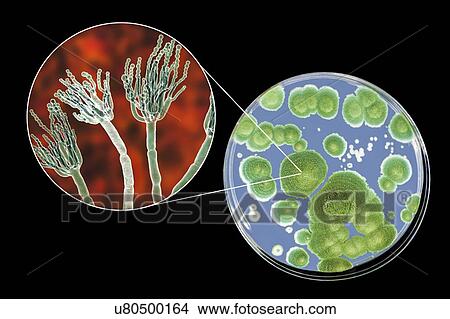 Penicillium fungus, photo of colonies of Penicillium fungi grown on Sabouraud Dextrose Agar and computer illustration of fungal morphology. Penicillium fungus causes food spoilage and produces the antibiotic penicillin. There are over 100 species of... View Large Photo Image Picture - Penicillium fungus, photo of colonies of Penicillium fungi grown on Sabouraud Dextrose Agar and computer illustration of fungal morphology. Penicillium fungus causes food spoilage and produces the antibiotic penicillin. There are over 100 species of.... Fotosearch