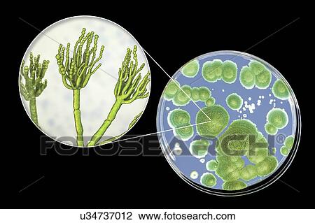 Stock Image - Penicillium fungus, photo of colonies of Penicillium fungi grown on Sabouraud Dextrose Agar and computer illustration of fungal morphology. Penicillium fungus causes food spoilage and produces the antibiotic penicillin. There are over 100 species of.... Fotosearch