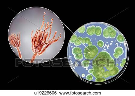 Stock Photograph - Penicillium fungus, photo of colonies of Penicillium fungi grown on Sabouraud Dextrose Agar and computer illustration of fungal morphology. Penicillium fungus causes food spoilage and produces the antibiotic penicillin. There are over 100 species of.... Fotosearch