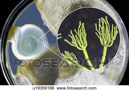 Stock Photograph - Penicillium fungus, photo of colonies of Penicillium fungi grown on Sabouraud Dextrose Agar and computer illustration of fungal morphology. Penicillium fungus causes food spoilage and produces the antibiotic penicillin. There are over 100 species of.... Fotosearch
