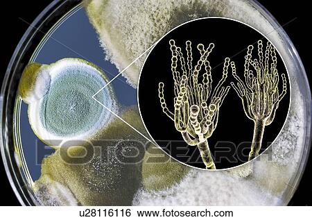 Penicillium fungus, photo of colonies of Penicillium fungi grown on Sabouraud Dextrose Agar and computer illustration of fungal morphology. Penicillium fungus causes food spoilage and produces the antibiotic penicillin. There are over 100 species of... View Large Photo Image Stock Photograph - Penicillium fungus, photo of colonies of Penicillium fungi grown on Sabouraud Dextrose Agar and computer illustration of fungal morphology. Penicillium fungus causes food spoilage and produces the antibiotic penicillin. There are over 100 species of.... Fotosearch