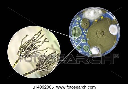 Stock Photography - Penicillium fungus, photo of colonies of Penicillium fungi grown on Sabouraud Dextrose Agar and computer illustration of fungal morphology. Penicillium fungus causes food spoilage and produces the antibiotic penicillin. There are over 100 species of.... Fotosearch
