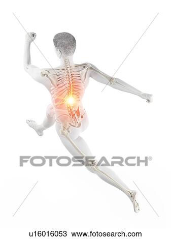 Stock Image - Runner with back pain, conceptual illustration.. Fotosearch