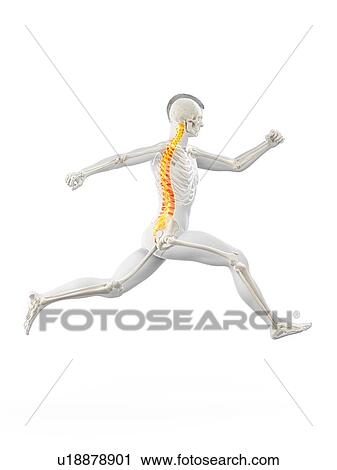 Stock Image - Runner with back pain, conceptual illustration.. Fotosearch