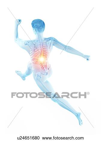 Stock Image - Runner with back pain, conceptual illustration.. Fotosearch