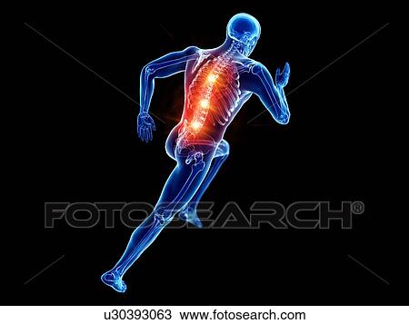 Runner with back pain, conceptual computer illustration. View Large Photo Image Stock Image - Runner with back pain, conceptual computer illustration.. Fotosearch