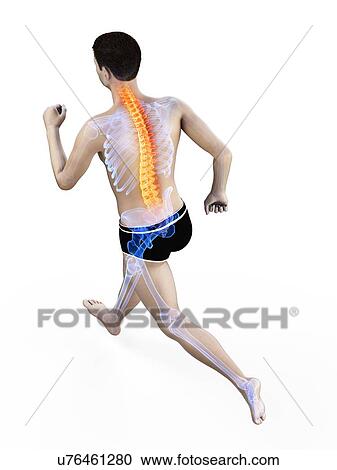 Stock Image - Runner with back pain, conceptual illustration.. Fotosearch