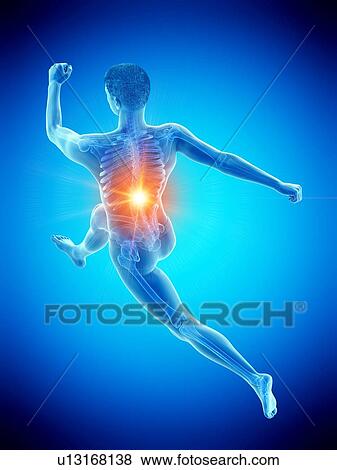 Runner with back pain, conceptual illustration. View Large Photo Image Stock Photo - Runner with back pain, conceptual illustration.. Fotosearch