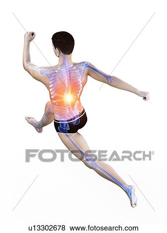 Runner with back pain, conceptual illustration. View Large Photo Image Stock Photo - Runner with back pain, conceptual illustration.. Fotosearch
