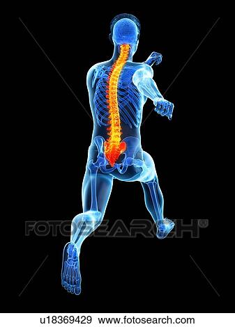Stock Photo - Runner with back pain, conceptual illustration.. Fotosearch