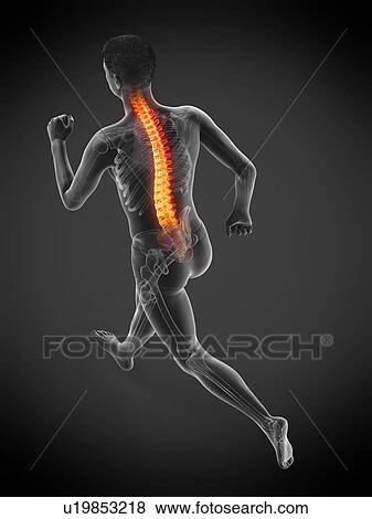Runner with back pain, conceptual illustration. View Large Photo Image Stock Photo - Runner with back pain, conceptual illustration.. Fotosearch
