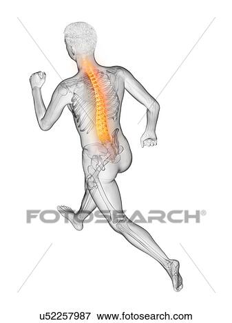 Runner with back pain, conceptual illustration. View Large Photo Image Stock Photo - Runner with back pain, conceptual illustration.. Fotosearch