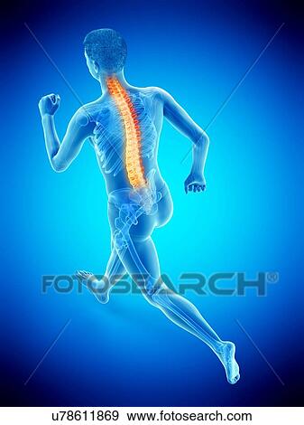 Stock Photo - Runner with back pain, conceptual illustration.. Fotosearch